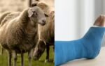 scientists turn sheep wool into a bone healing material in a major medical breakthrough