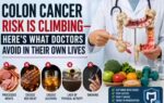 what colorectal surgeons avoid to lower their risk of colon cancer