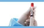 anemia data not released