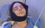 youtuber rosanna pansino undergoes surgery after breaking jaw in boat accident