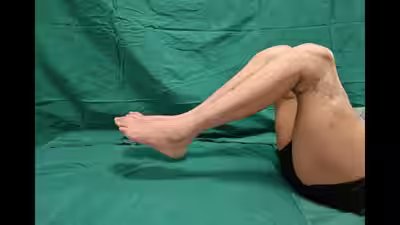 a chinese factory worker got two new legs implanted after he lost both his legs in an accident