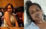a woman booked a bike ride to work and woke up with 9 broken ribs and no spleen
