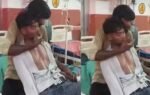 hardoi man slapped 150 times after snake bite